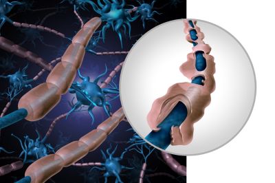 מתנגודת לטרשת: מסלול ידוע מראש